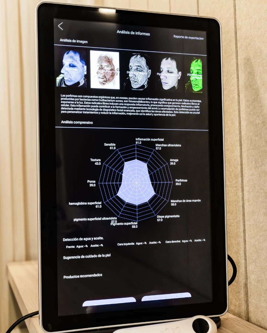 Scanner Viewskin · Análisis y seguimiento — miniatura 4